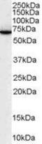 SWAP70 antibody, GTX89933, GeneTex, Western Blot image 