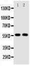 Transforming Growth Factor Beta Receptor 1 antibody, PA5-80118, Invitrogen Antibodies, Western Blot image 