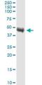 Tribbles Pseudokinase 1 antibody, H00010221-M01, Novus Biologicals, Western Blot image 