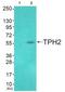 Tryptophan Hydroxylase 2 antibody, TA316054, Origene, Western Blot image 