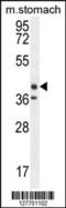 Tectorin Beta antibody, 55-120, ProSci, Western Blot image 