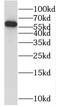 Protein Phosphatase 3 Catalytic Subunit Beta antibody, FNab06727, FineTest, Western Blot image 