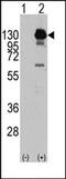 Platelet Derived Growth Factor Receptor Alpha antibody, AP14394PU-N, Origene, Western Blot image 