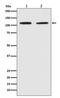 PMS1 Homolog 2, Mismatch Repair System Component antibody, M01028-1, Boster Biological Technology, Western Blot image 