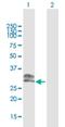 Charged Multivesicular Body Protein 1A antibody, H00005119-B02P, Novus Biologicals, Western Blot image 