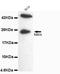 RAB2A, Member RAS Oncogene Family antibody, LS-C178344, Lifespan Biosciences, Western Blot image 