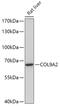 CO9A2 antibody, 16-951, ProSci, Western Blot image 