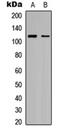 RB Transcriptional Corepressor 1 antibody, orb304543, Biorbyt, Western Blot image 