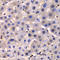 Inhibitor Of Nuclear Factor Kappa B Kinase Regulatory Subunit Gamma antibody, STJ114410, St John