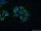 Glutamic-Oxaloacetic Transaminase 1 antibody, 60317-1-Ig, Proteintech Group, Immunofluorescence image 