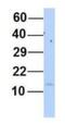 Myosin light polypeptide 6 antibody, NBP1-54376, Novus Biologicals, Western Blot image 