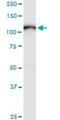 ADAM Metallopeptidase Domain 17 antibody, H00006868-M01, Novus Biologicals, Western Blot image 