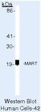 Melan-A antibody, MA5-14017, Invitrogen Antibodies, Western Blot image 