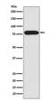 Interleukin 1 Receptor Associated Kinase 1 antibody, M01021, Boster Biological Technology, Western Blot image 