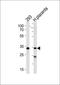 Interleukin 11 antibody, orb251615, Biorbyt, Western Blot image 