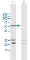 Uncharacterized protein C1orf103 antibody, H00055791-B01P, Novus Biologicals, Western Blot image 