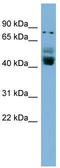 Zinc Finger Protein 620 antibody, TA339820, Origene, Western Blot image 