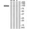 DEAD-Box Helicase 54 antibody, A08923, Boster Biological Technology, Western Blot image 
