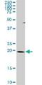 THAP domain-containing protein 1 antibody, H00055145-D01P, Novus Biologicals, Western Blot image 