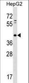 Phospholipid Phosphatase Related 5 antibody, LS-C163358, Lifespan Biosciences, Western Blot image 