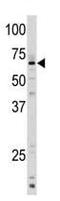 Cytochrome P450 Family 1 Subfamily A Member 1 antibody, ab79819, Abcam, Western Blot image 