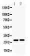 Insulin Like Growth Factor Binding Protein 1 antibody, PB9604, Boster Biological Technology, Western Blot image 