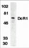 TNF Receptor Superfamily Member 10c antibody, 2179, ProSci, Western Blot image 