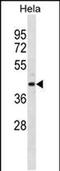 ARH1 antibody, PA5-49268, Invitrogen Antibodies, Western Blot image 