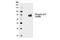 Tumor Protein P73 antibody, 4665S, Cell Signaling Technology, Western Blot image 