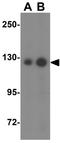 Adaptor Related Protein Complex 3 Subunit Beta 2 antibody, GTX17145, GeneTex, Western Blot image 