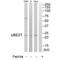Ubiquitin Conjugating Enzyme E2 T antibody, PA5-50159, Invitrogen Antibodies, Western Blot image 