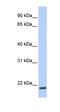 Transmembrane Protein 35A antibody, orb325496, Biorbyt, Western Blot image 