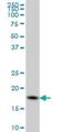 Cofilin 1 antibody, H00001072-M04, Novus Biologicals, Western Blot image 