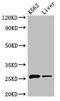 N-Ribosyldihydronicotinamide:Quinone Reductase 2 antibody, CSB-PA016040LA01HU, Cusabio, Western Blot image 