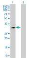 Charged Multivesicular Body Protein 1A antibody, H00005119-D01P, Novus Biologicals, Western Blot image 