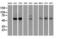Checkpoint Kinase 2 antibody, LS-C784233, Lifespan Biosciences, Western Blot image 
