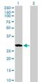 RAS Like Family 11 Member B antibody, H00065997-B01P, Novus Biologicals, Western Blot image 