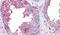 Solute Carrier Family 39 Member 6 antibody, PA5-33036, Invitrogen Antibodies, Immunohistochemistry paraffin image 
