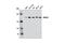 Rho Associated Coiled-Coil Containing Protein Kinase 2 antibody, 9029S, Cell Signaling Technology, Western Blot image 