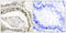SMAD Family Member 3 antibody, LS-C199586, Lifespan Biosciences, Immunohistochemistry paraffin image 