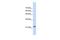 RAS Like Family 10 Member A antibody, GTX45802, GeneTex, Western Blot image 