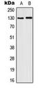 Colony Stimulating Factor 2 Receptor Beta Common Subunit antibody, LS-C353947, Lifespan Biosciences, Western Blot image 