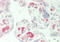 Phospholipase A2 Group IIE antibody, ARP47041_P050, Aviva Systems Biology, Immunohistochemistry paraffin image 