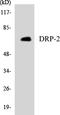 Dihydropyrimidinase Like 2 antibody, LS-B12485, Lifespan Biosciences, Western Blot image 