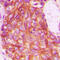 Atypical Chemokine Receptor 3 antibody, GTX55967, GeneTex, Immunohistochemistry paraffin image 