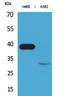 CP-2 antibody, STJ96489, St John