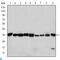 Cyclin Dependent Kinase 1 antibody, LS-C812542, Lifespan Biosciences, Immunohistochemistry paraffin image 