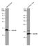 Ubiquinol-Cytochrome C Reductase Binding Protein antibody, GTX130895, GeneTex, Western Blot image 