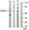 Treacher Collins syndrome protein antibody, A02653, Boster Biological Technology, Western Blot image 