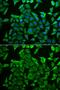 Arginyl-TRNA Synthetase antibody, GTX65850, GeneTex, Immunocytochemistry image 